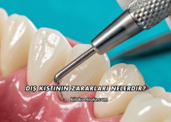 Diş Kistinin Zararları Nelerdir?