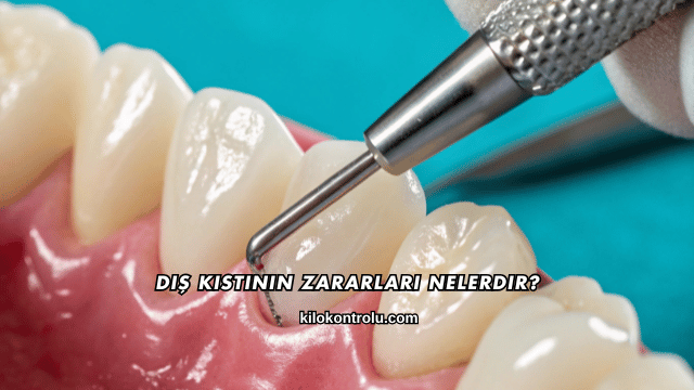 Diş Kistinin Zararları Nelerdir?