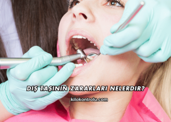 Diş Taşının Zararları Nelerdir?