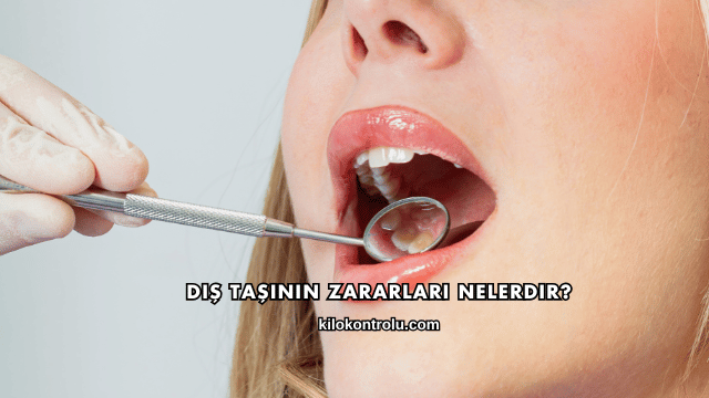 Diş Taşının Zararları Nelerdir?