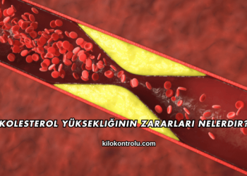 Kolesterol Yüksekliğinin Zararları Nelerdir?