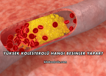 Yüksek Kolesterolü Hangi Besinler Yapar?